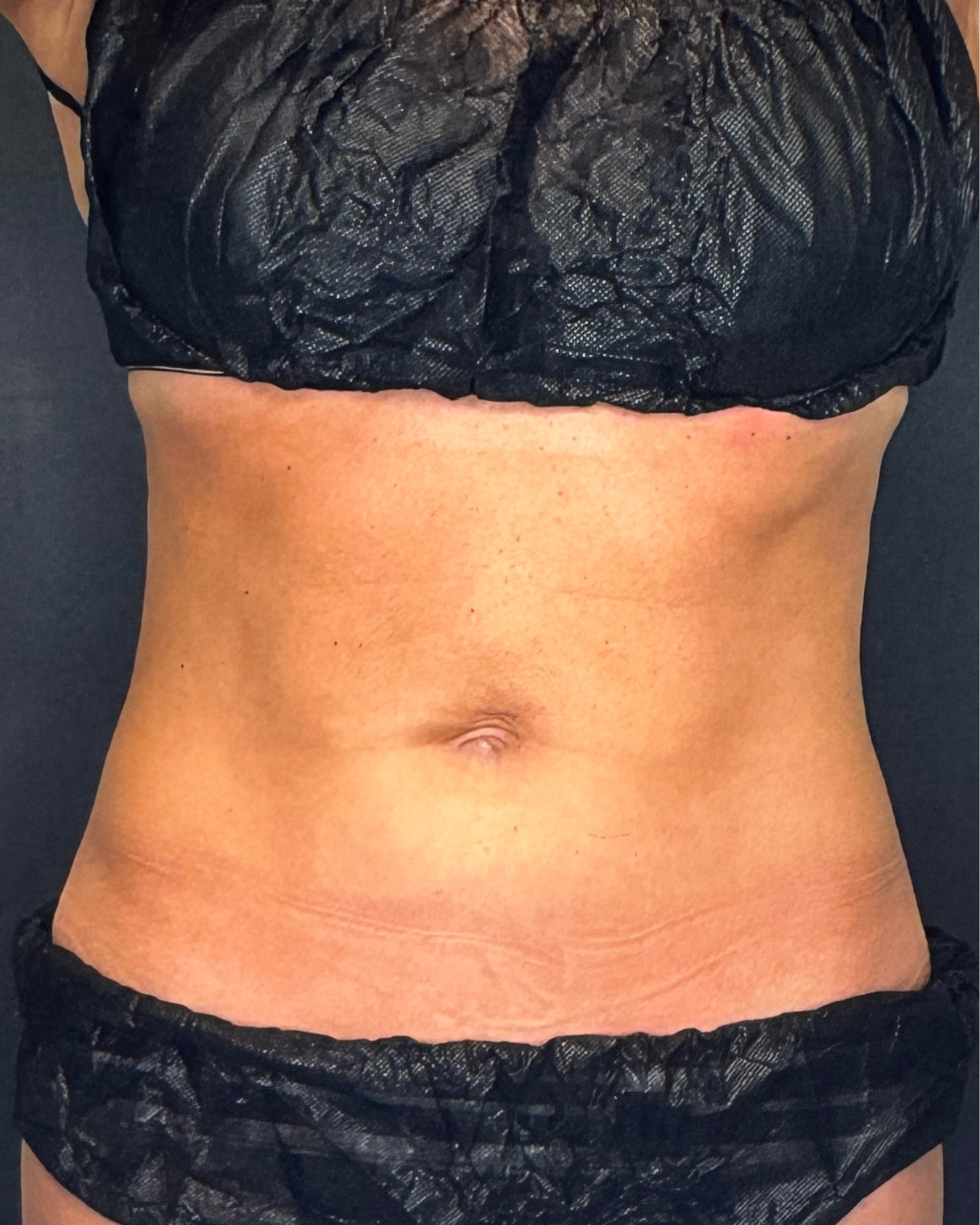 plushcare glp-1 cost I Tried Therapy at PlushCare: Here's My Review