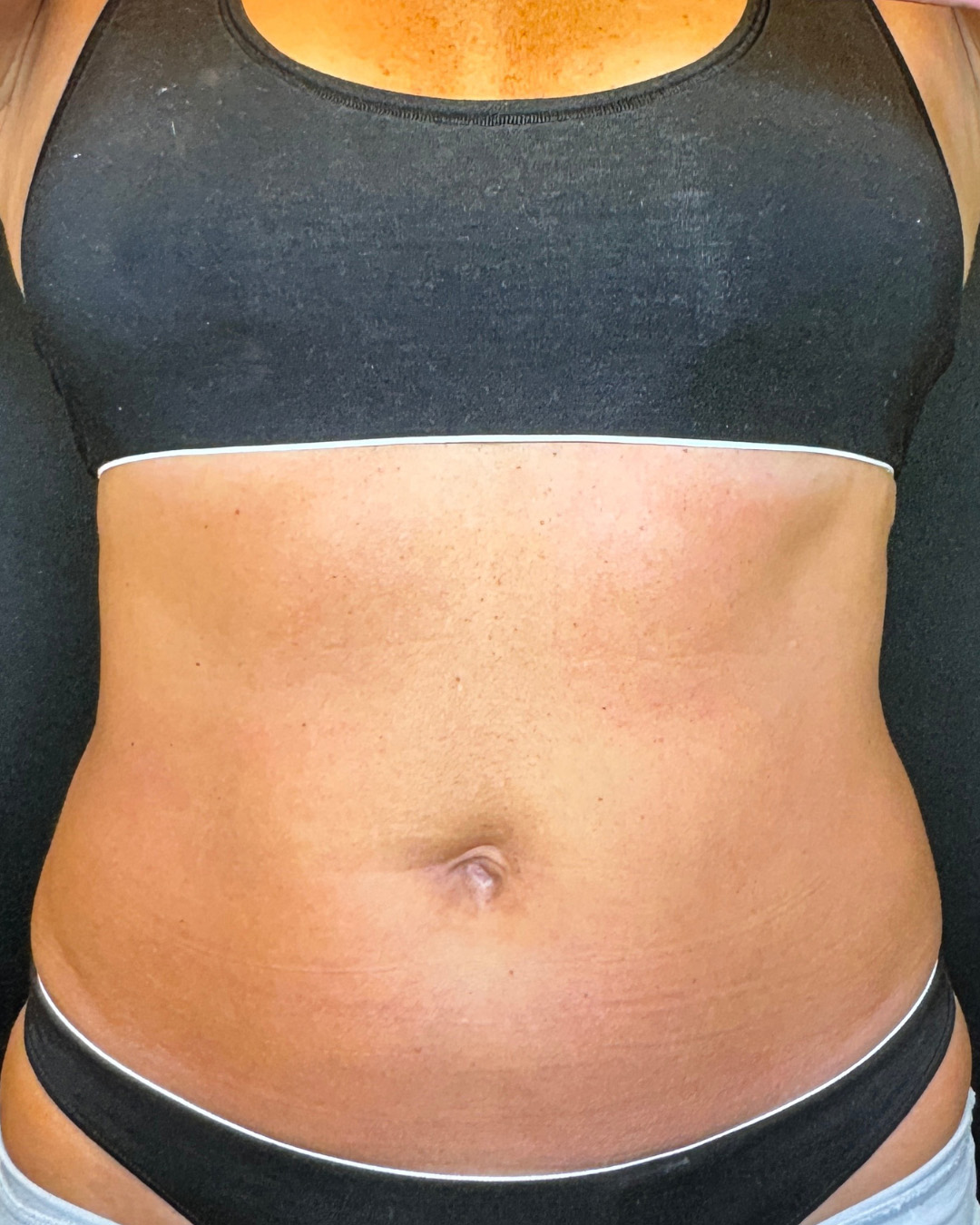 glp-1 therapy for weight loss GLP-1 Weight Loss Specialist in Langhorne and Philadelphia, PA