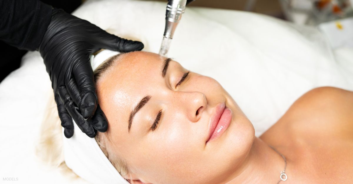 A woman getting a microneedling treatment at a spa. (Models)