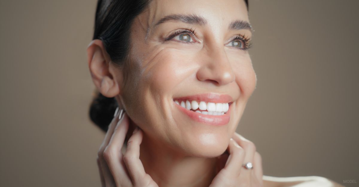 Woman with rejuvenated eyes after under eye filler. (Model)