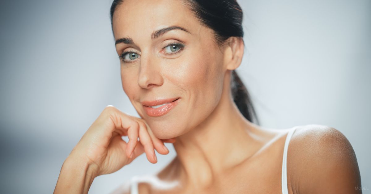 Woman after sculptra treatments. (Model)