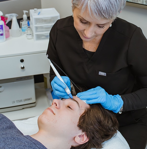 Agnes RF Microneedling Treatment on Forehead Agnes RF Microneedling Treatment on Forehead