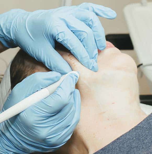 Agnes RF Skin tightening Agnes RF Skin tightening