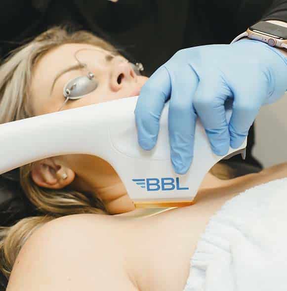BBL HERO treatment for face and body