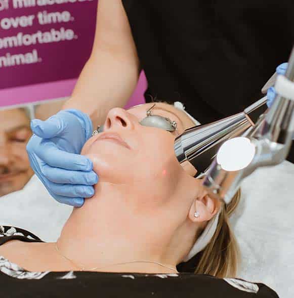 Up close laser resurfacing treatment