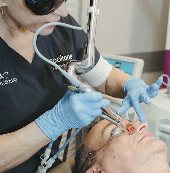 Laser vein removal on a man's nose
