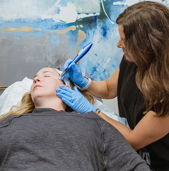 Microneedling-1 physician microneedles patients face to improve skin texture.