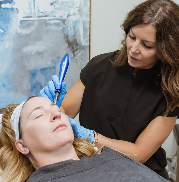 Microneedling-2 physician microneedling patient's forehead with Rejuvapen while patient lies comfortably on her back.