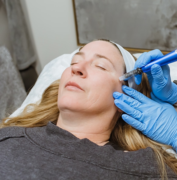 Close up of patient and the microneedling pen by rejuvapen