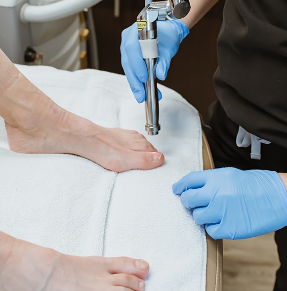 Laser right above a toe with toe nail fungus