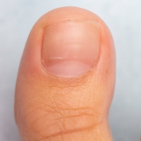 Healthy big toe and nail