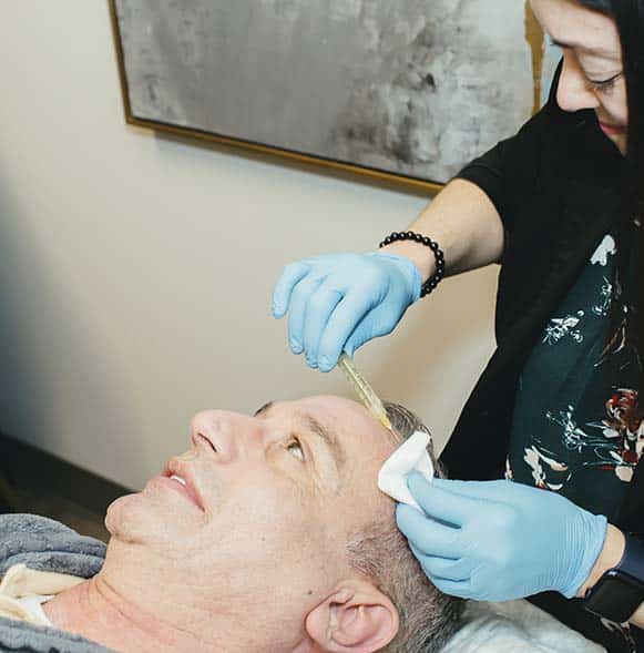 PRP Hair Restoration with ARNP PRP Hair Restoration with ARNP