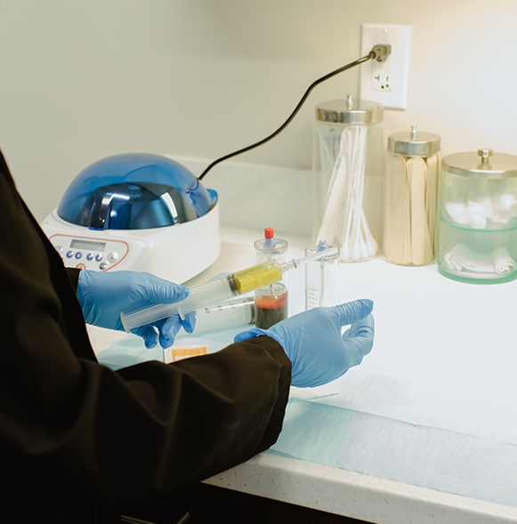 VFL -2 Physician has taken the PRP from the red blood cells and has put it into a syringe.